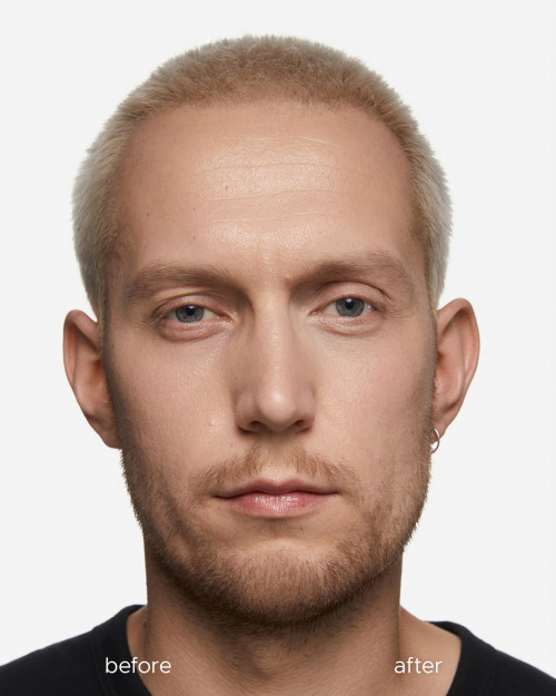 Peptid-Lifting-Augenconcealer